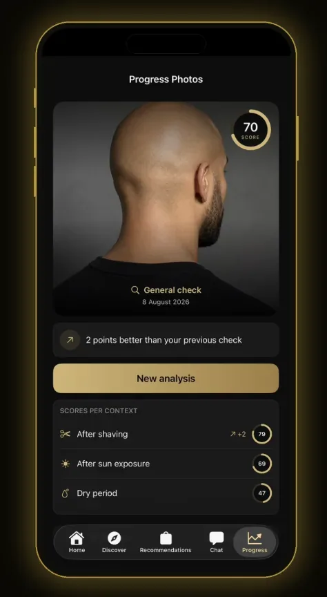 BaldCare progress photos